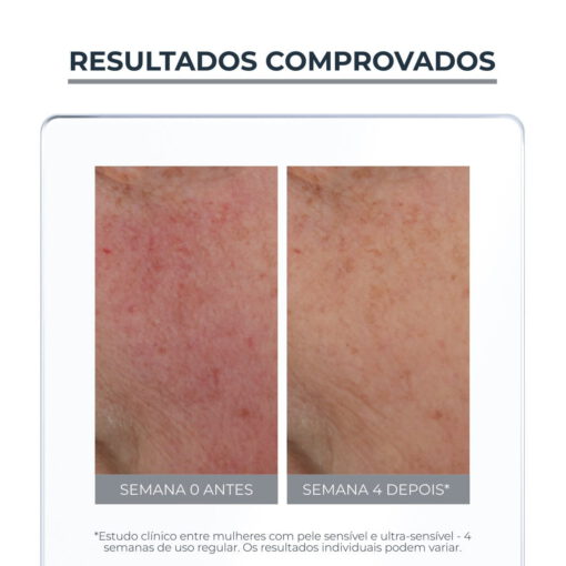 Eucerin Anti Redness Fluido Neutralizante Tinted FPS 30 50ml - Image 3