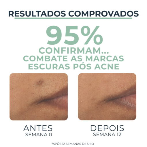 Eucerin Dermo Pure Sérum Facial Efeito Triplo 40ml - Image 4