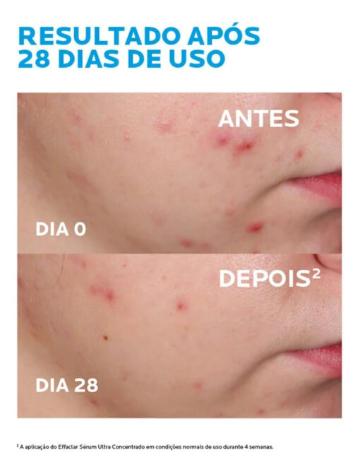 EFFACLAR SÉRUM ULTRA CONCENTRADO 15ml - Image 4